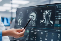 A doctor looking at the results of an MRI scan.